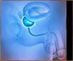 Prostate Enlargement